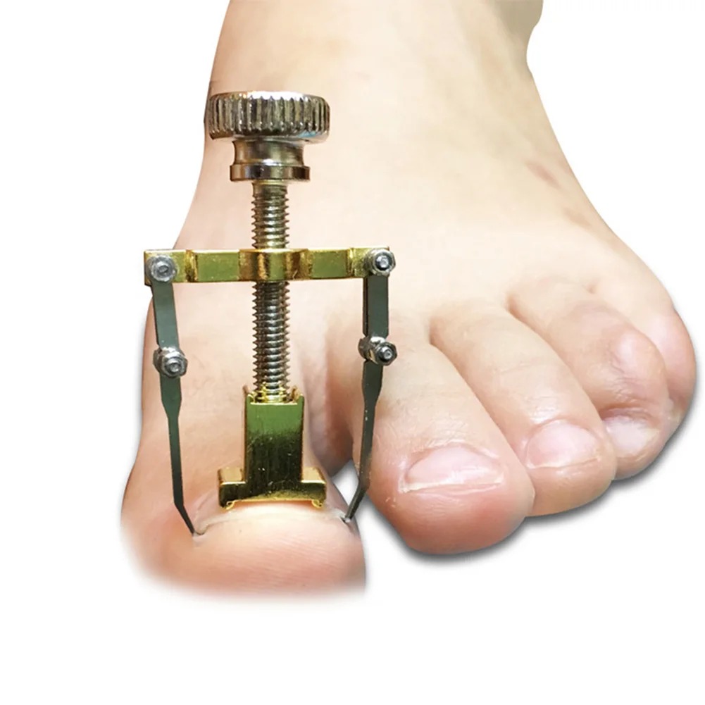 Toes Treatment Tools Ingrown Toe File Nail Correction Cleaner Toes