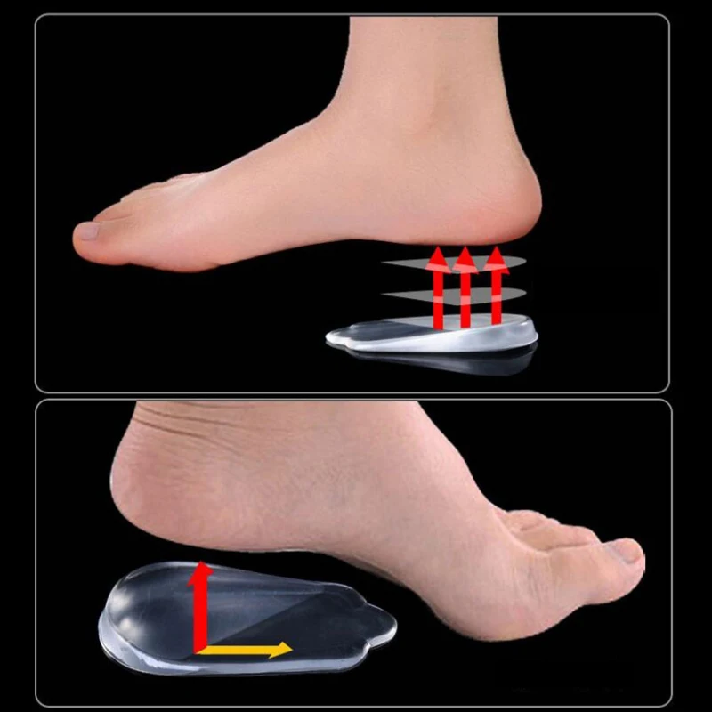 

Correction Heel Pad Adult Children Silicone Type O Type X Leg Insole Leg Type Corrective Heel Pad Feet Care