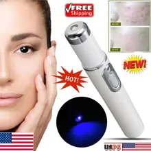 Спецодежда медицинская синий/красный свет лазерная терапия лечения ручка акне устройство для устранений морщин Лидер продаж уход за лицом инструменты