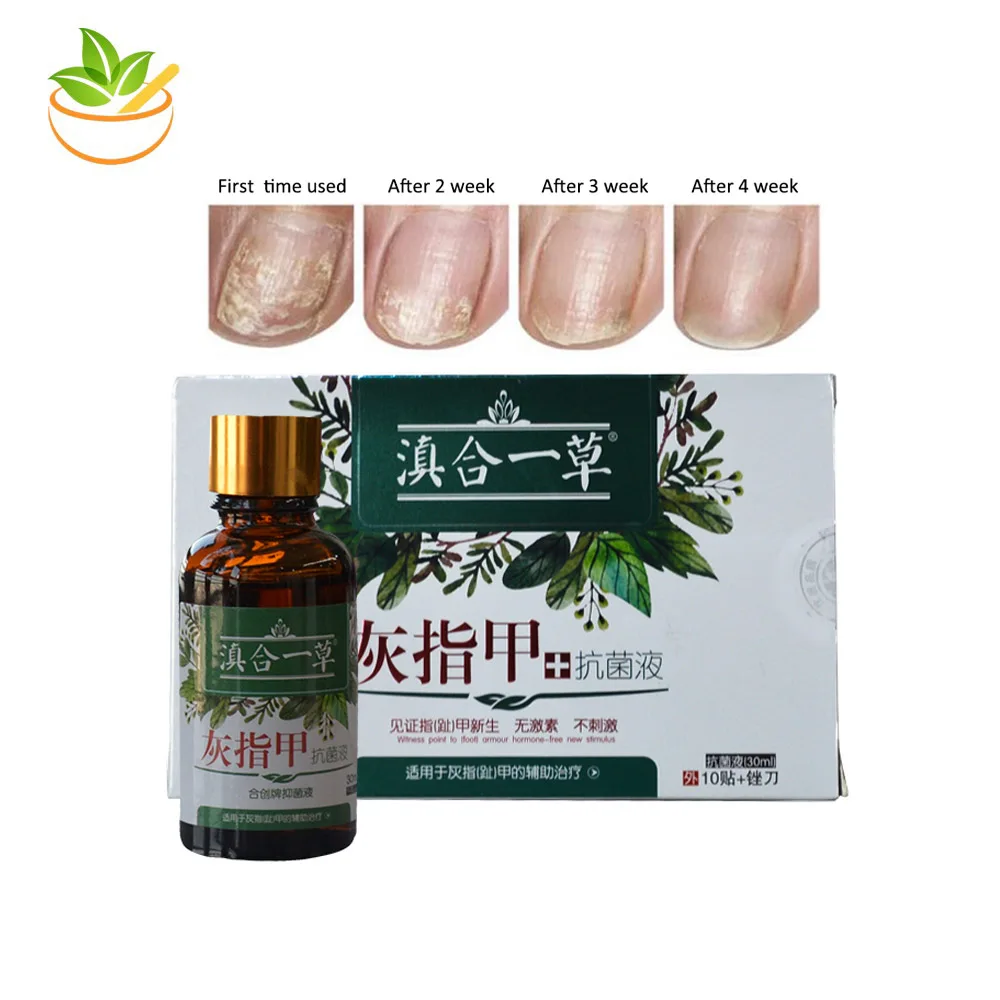 

2 PCS Remedy For Nail Fungus Treatment Feet Nail Care Essence Toe Foot Fungal Remove Gel Antifungal Onychomycosis Cream