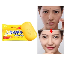 Горячая Распродажа 1 шт Шанхай серное мыло для 4 кожных условий от акне, псориаза себорейного клеща противогрибковое