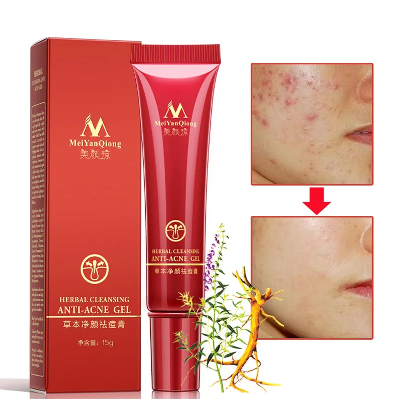 Herbal Cleansing Gel Anti Acne Treatment Cream Herbal Scar Removal Oily Skin Acne Spots Skin