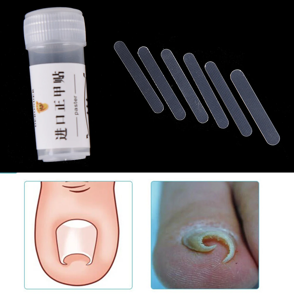 

5Pcs/box Professional Foot Care Tool Ingrown Toe Nail Correction Sticker Patch Paronychia Correction File Acronyx Wire Corrector