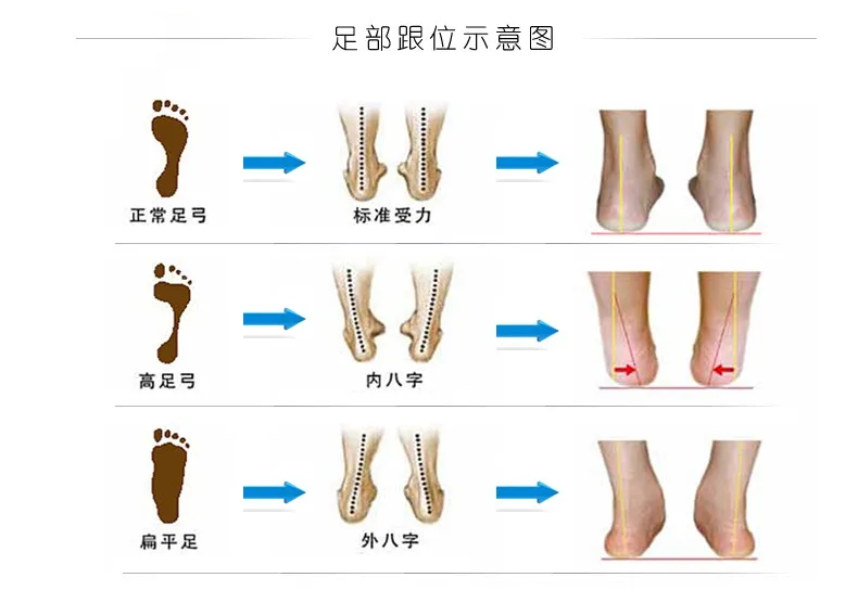 Ортопедические стельки для плоской стопы X-Leg 8-Shaped для коррекции ног стелька под пятку стельки для поддержки стопы ортопедические стельки из овчины 39-44