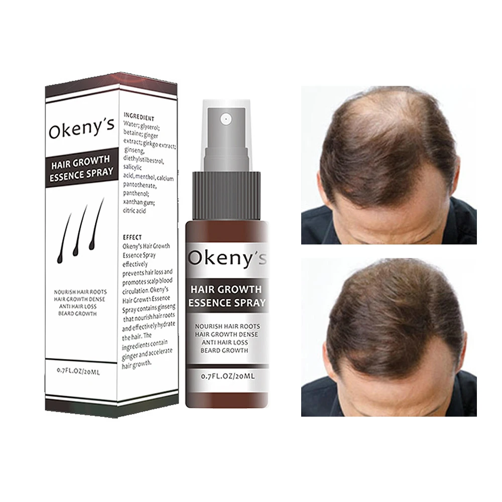 Средства от облысения отзывы. Hair loss treatment от выпадения. Китайская эссенция hair growth Spray. Средство для облысения для мужчин. Спрей для волос для мужчин от облысения.