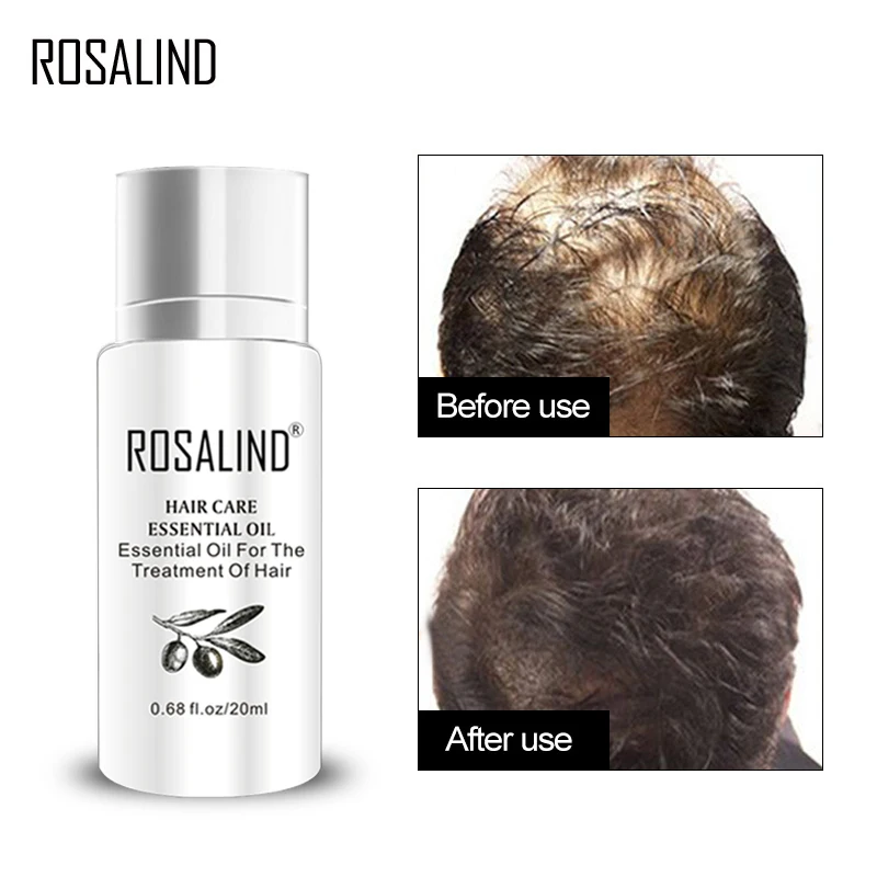 

ROSALIND Hair Care 20ml Keratin Treatment Hair Serum Hair Treatment Mask Keratin for Hair Nourish Scalp Repair Dry Damage