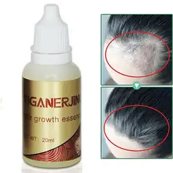 1 шт от выпадения волос масла продуктов органического ускоренный рост волос жидкий экстракт лечение выпадения волос быстрее роста волос TSLM2