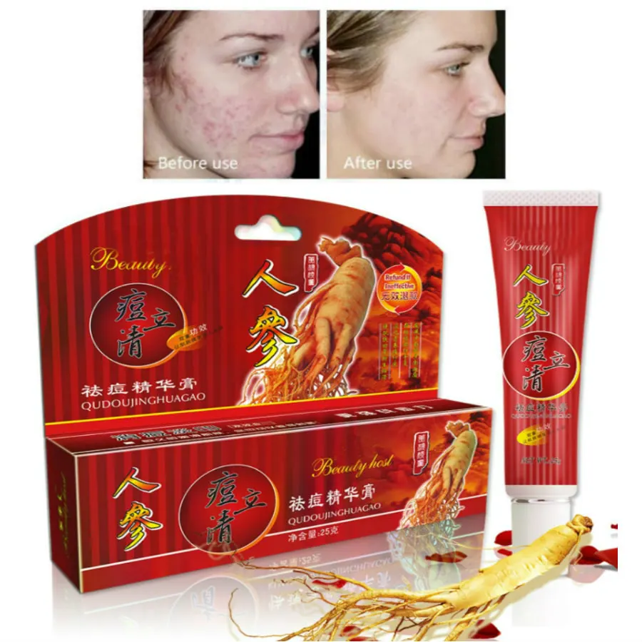 

Dimollaure herbal Ginseng Acne Treatment Blackhead Removal Anti Acne Cream Oil Control Shrink Pores Acne Scar Remove Face Care