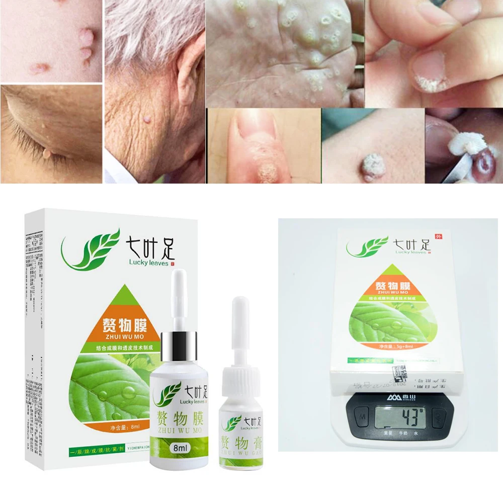 

100% Professional Skin Tag Remover Natural Health Mole Nevus Wart Skin Tag Foot Corn Warts Treatment Real Skin Removal D228