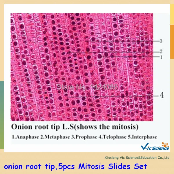 

onion root tip,5pcs Mitosis Slides Set Microscopical mitotic prepared slides