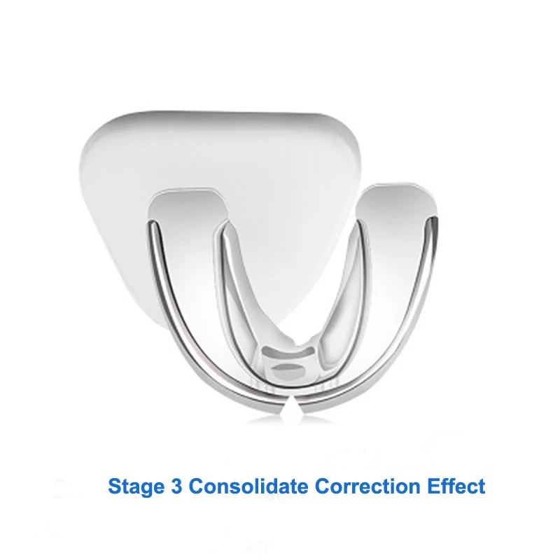 Подтяжки для рта мгновенный силиконовый смайлик выравнивание зубов тренажер ретейнер для зубов Защита рта Защитный Лоток для зубов 3 этапа - Цвет: 3rd stage