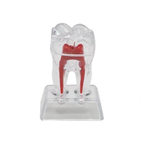 1 шт. маленький стоматологический зубной Кристалл основа жесткий пластик Зубы Зуб Молярная Модель Отделяемая 5,5 см* 5 см* 7 см