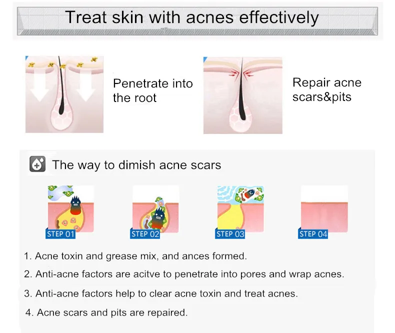 Акне ямы шрамы эссенция крем против акне retional сыворотка