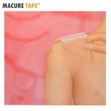 12 см* 8 см нашивки из силиконового геля шрам от терапия рана; шрам пасты удаление кесарево сечение гипертрофических келоидные лечение шрамов