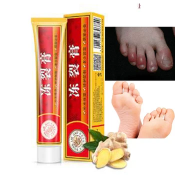 

Wholesale Powerful Hand Foot Crack Cream Heel Chapped Peeling Foot and hand Repair Anti Dry Crack skin care Ointment D197