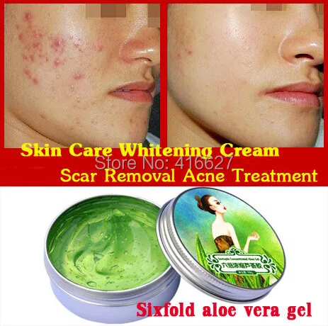 aloe vera cream for scars
