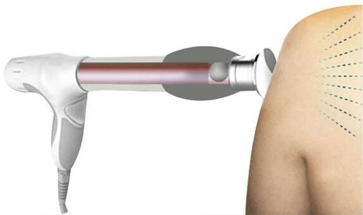 High Intensity !!! Radial Shock Wave Weight Loss Magnetic Therapy shockwave Acoustic Wave Body Slimming Pain Relief Salon Beauty Machine CE (2)
