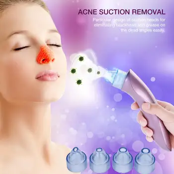 

Rechargeable USB Blackhead Absorbing Pore Suction Removing Skin Care Electric Face Cleaner