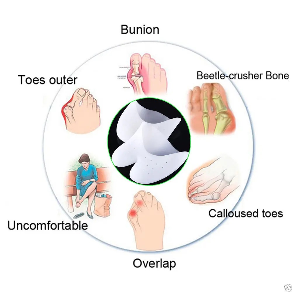 Цвет кожи/Белый силиконовый гелиевые стельки Pad снятие стресса протекторы стопы Корректор для ухода носком сепараторы кепки крышка