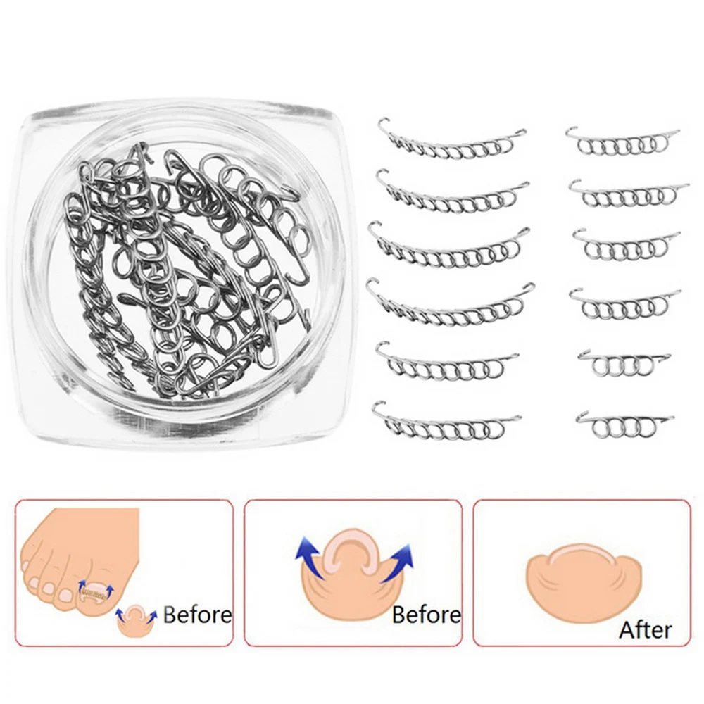 

12Pcs/Box Ingrown Toe Nail Correction Acronyx Wire Fixer Pedicure Recover Paronychia Corrector File Foot Care Tool