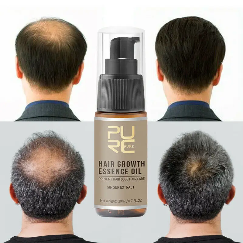 

Hair Growth Products Natural Oil Serum Loss Grow Fast Treatment Men Women 20ml