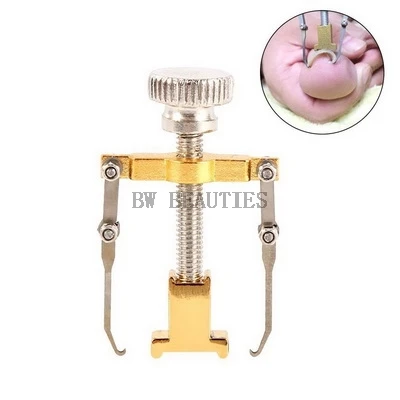 

100Pcs/Lot Ingrown Toe Nail Correction Pedicure Fixer Straightener Clippers Recover Set Clamp Scissors Nail Correction Device