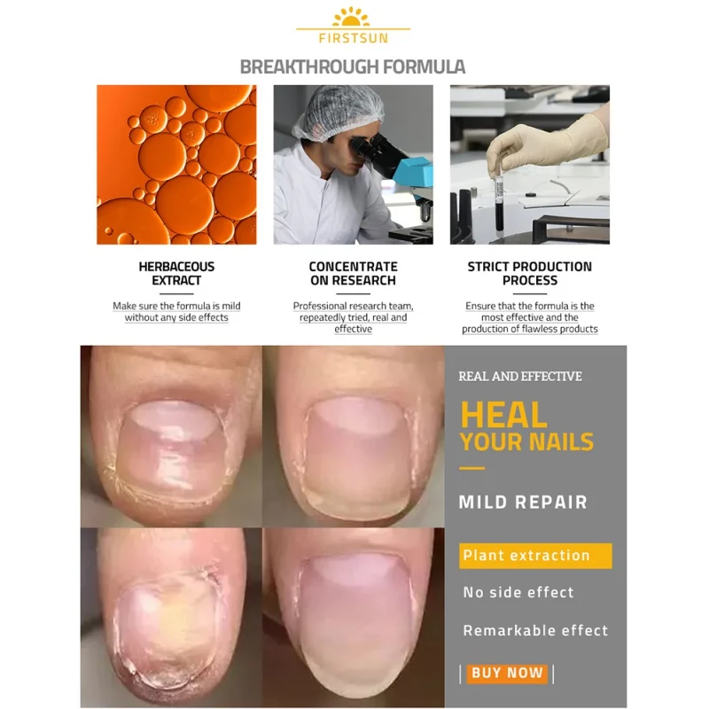 Hot High Quality Plant Extract Bactericidal Anti-inflammatory Orange Peel Tissue Moisturizing Gray Nail Bright Nail Care Cream