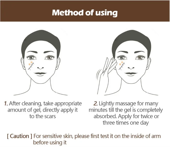 Cayman Сыворотка для женщин, шрам и акне, гель для удаления, для лица, тела, акне, послеродовой крем для восстановления шрамов, уход за кожей