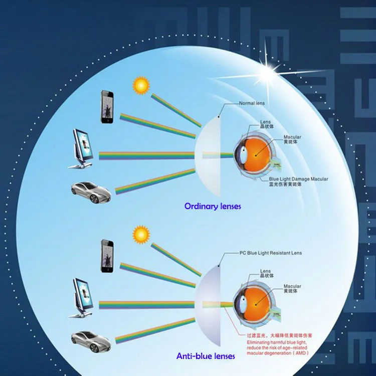 BCLEAR 1,61 рефракционный индекс, линзы с защитой от синего излучения, линзы с одним видением, дальнозоркость, синий светильник, защита глаз, компьютерные очки