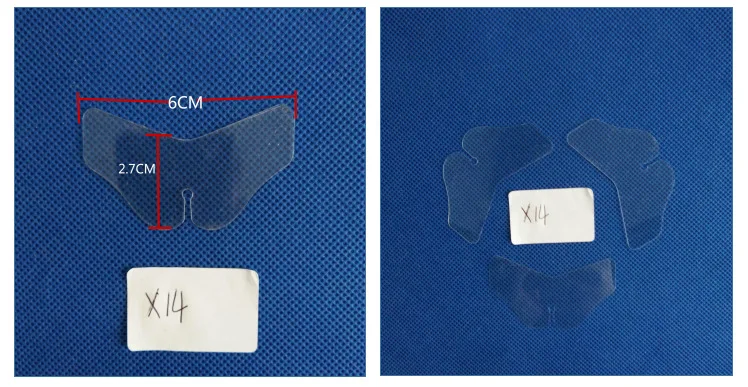 X14 Size