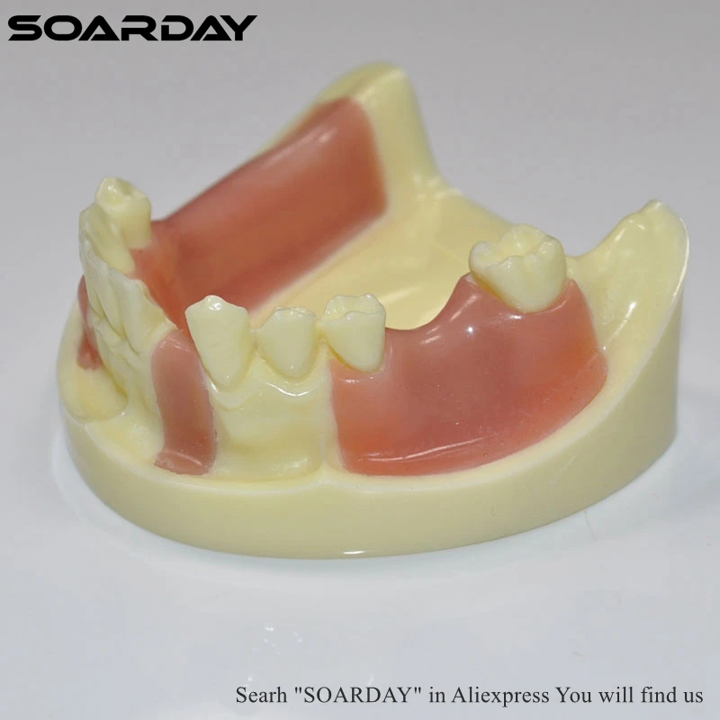 SOARDAY 1 шт. Имплантат практика модель различные зуба отсутствует с имитация кости Структура силиконовые