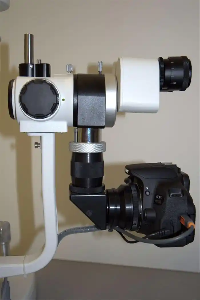 How powerful would a digital opthalmoscope be to see eye floaters? r