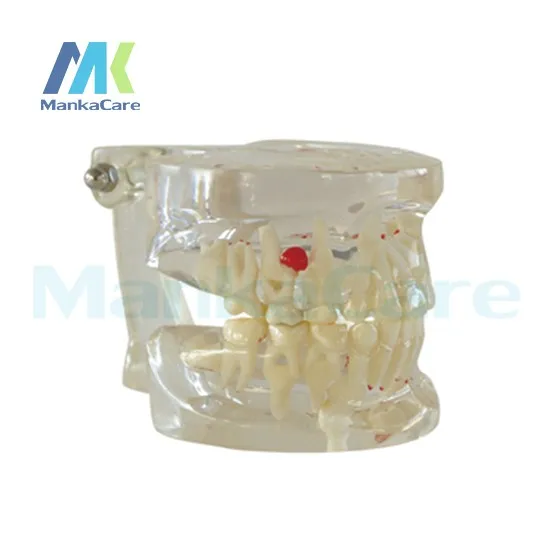 Manka Cuidar-claro Misturado Idade Modelo Dente Dentes Orais 4 Cheap tooth model