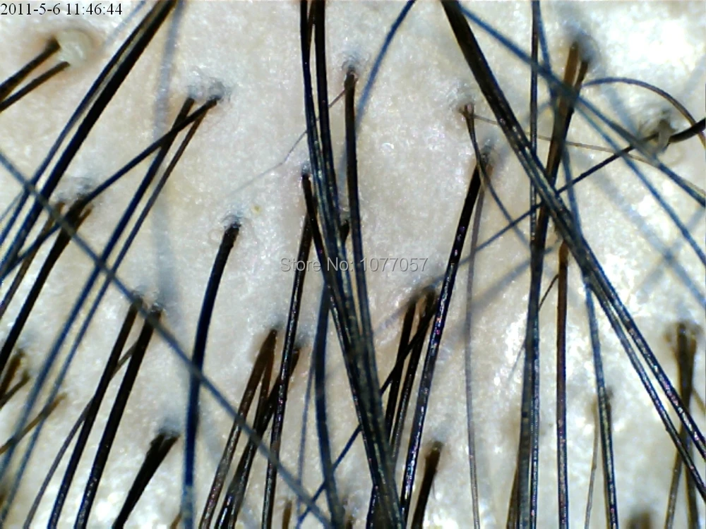 Liberi La Nave Ce Iso Pelle Capelli Portatile Microscope 1 3 M Pixel Microscopio Digitale Usb Con 400x Ingrandimento Microscope With Usb Camera Microscope Freemicroscope Stand Aliexpress