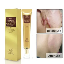 Уход за кожей восстанавливающий крем для лица LANBENA EGF удалитель шрамов крем растягивающийся гель против акне крем лечение угрей отбеливание черных точек