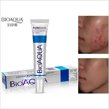 

50pcs/lot 100% BIOAQUA Anti Acne Cream Moisturizing Oil Contorl Skin Care Face Cream 30g Shrink Pores Nourishing Essentials