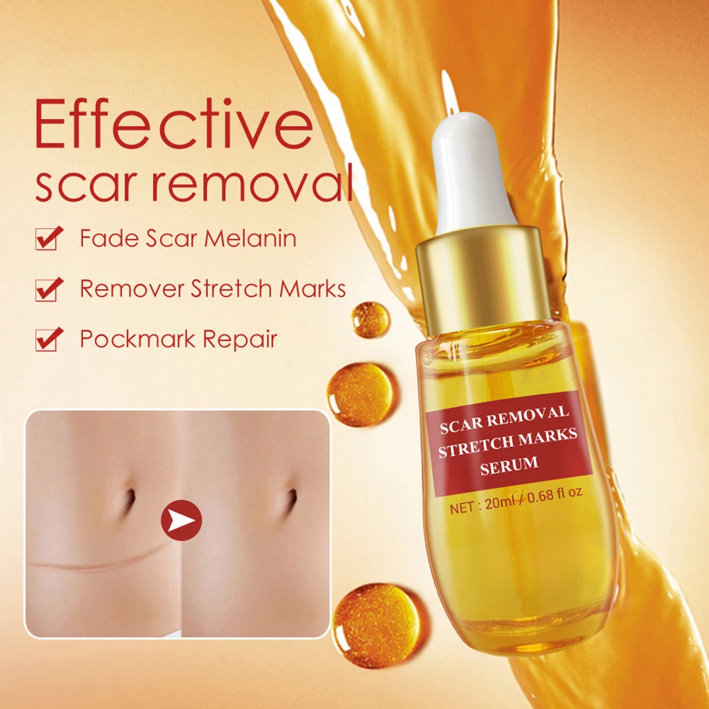 Professional Make Up  20ml Acne Scar Remove Serum Acne Treatment Remover Stretch Marks Anti Acne