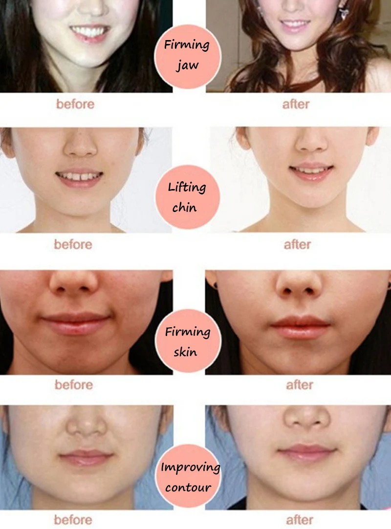 face lifting mask8