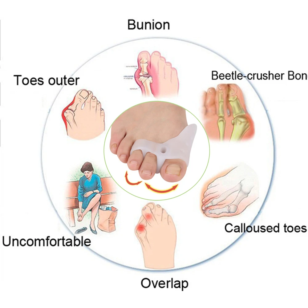 4 шт. силиконовый разделитель для пальцев ног защита носка стопы гелевые подушечки Hallux вальгусные ортопедические, для ступней уход за большим пальцем поперечный D0430