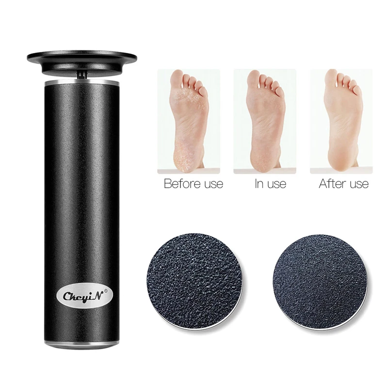 

Electric Callus Remover Dead Skin Callus Remover Pedicure Foot Care Tools Stainless Steel Callus Remover Foot File Scraper 34