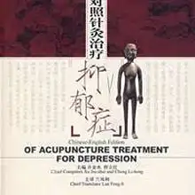 Английский Edition акупунктуры для лечения депрессии [Мягкая обложка] используется