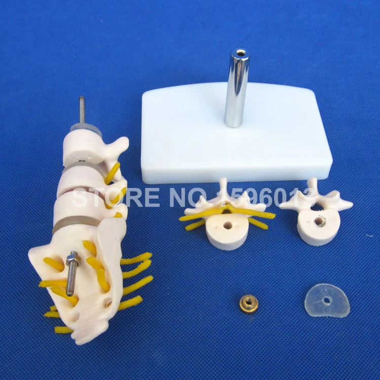 119A lumbar vertebrae (6)