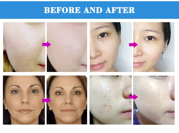 Portable super crystal    skin care  diamond microdermabrasion   Facial  peeling  Beauty  Tools