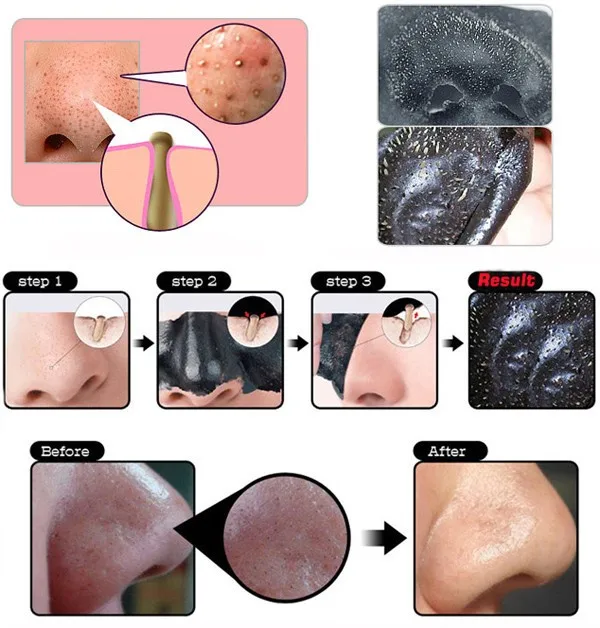 Новая маска для ухода за кожей лица, всасывающая черная кожура, Глубокая чистка носа, средство для удаления черных точек, очищающее кожу черной головы, лечение акне