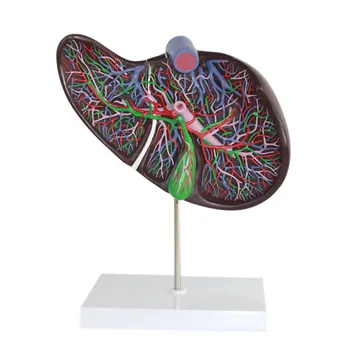 

Liver gallbladder enlargement model Gallbladder anatomical model