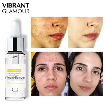 

VIBRANT GLAMOUR Snail 100% Plant Extract Face Serum Hyaluronic Acid Liquid Whitening Blemish Essence Mosturizing Anti-acne