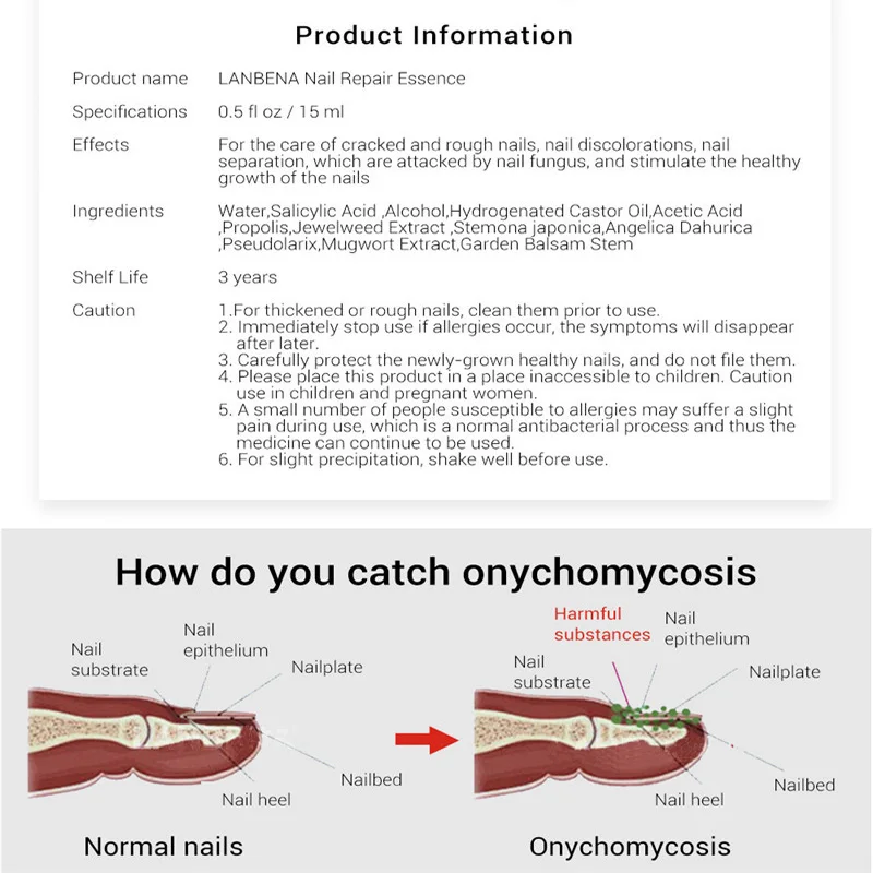 Жидкость для лечения сущность и ноги отбеливающий носком ногтей Удаление грибка Уход за ногтями гель для онихомикоз ногтей ноги