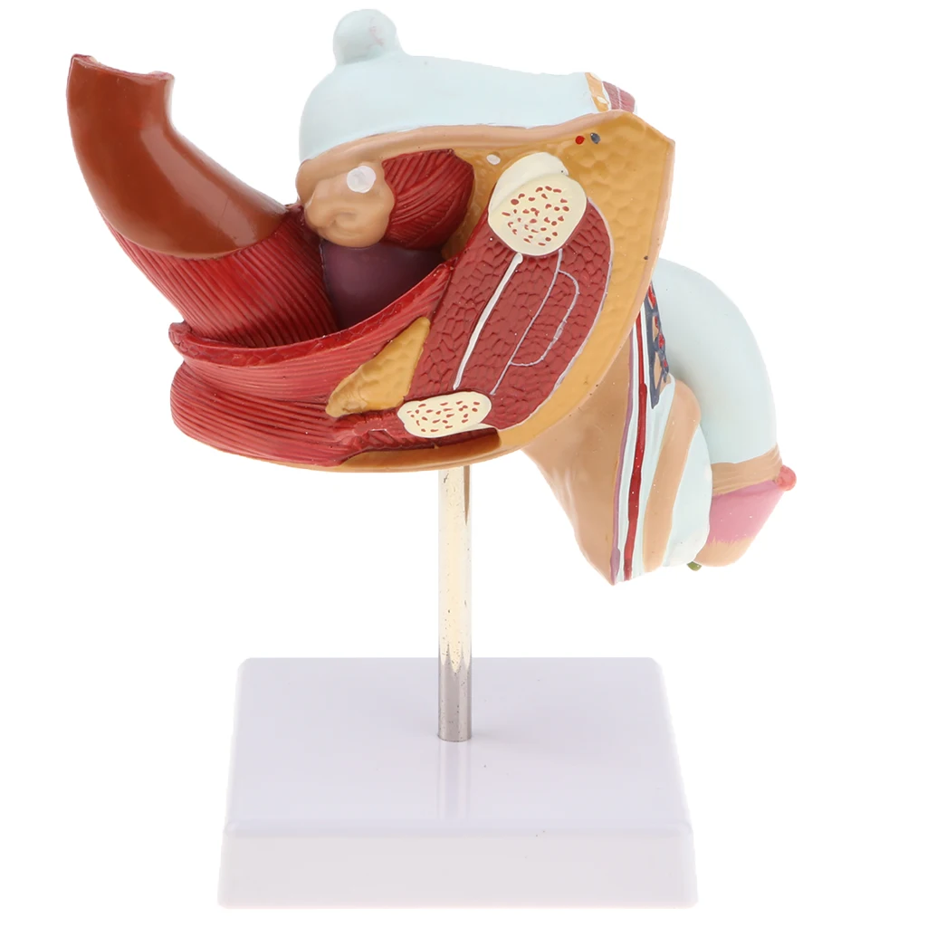 1:1 Human Male Reproduction Urinary System Pathlology Model Gonorrhea Ureteral Calculus Display Medical Study Lab Supplies