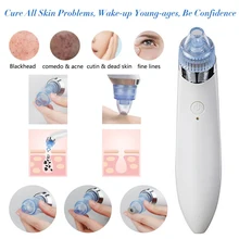 Electric Mini Handheld Dead Skin Acne Vacuum Suction Blackhead Removal Face Lifting Skin Tightening Rejuvenation Beauty Machine