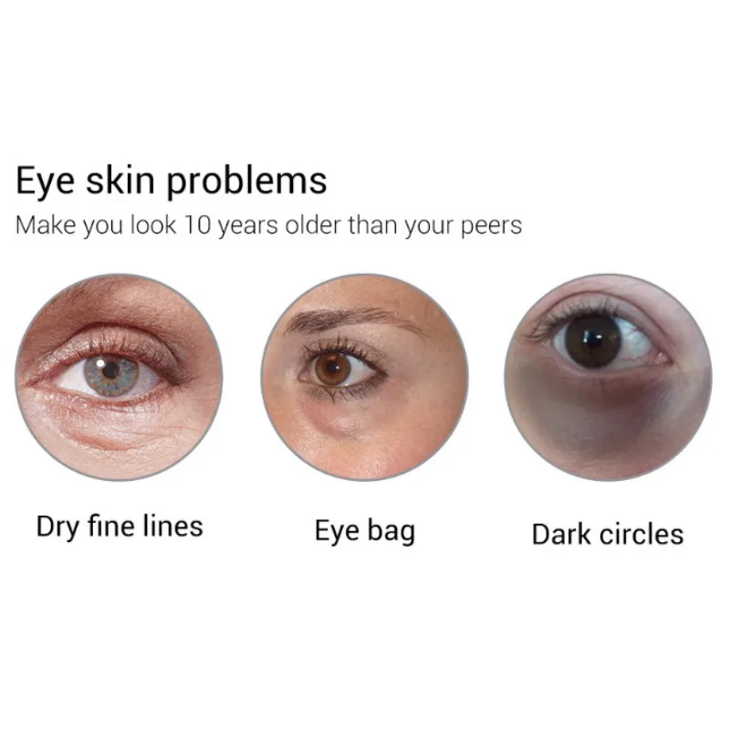 20 г крем для глаз увлажненитель с гиалуроновой кислотой удаляет мешки для глаз/отбеливающий Витамин С/ретинол анти-Ageless укрепляющий уход за кожей вокруг глаз